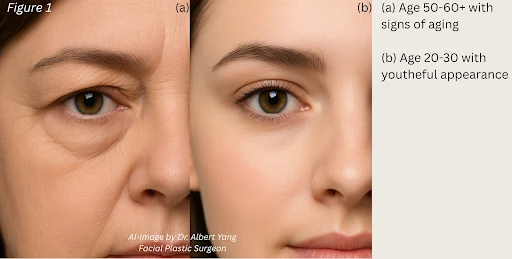Comparison of eye area showing signs of aging in an older adult (a) versus youthful appearance in a younger adult (b).
