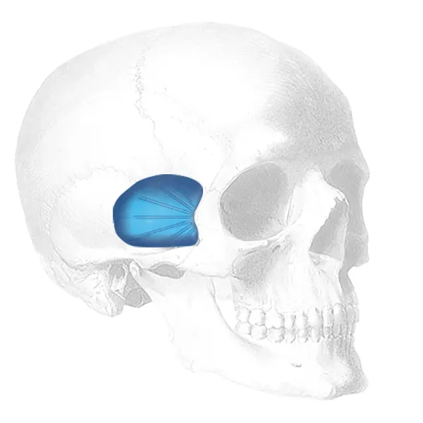 facial implant skull photo